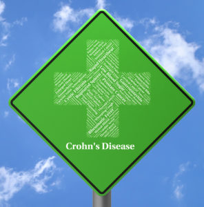 Crohn's disease sign