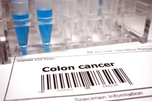 Colon Cancer Screening