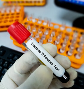 Blood sample for lactose Tolerance test.