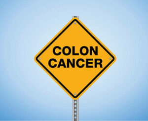 WARNING SIGN for colon cancer