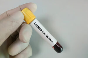Blood sample for lactose intolerance test