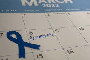 Colonoscopy Date Marked on the Calendar