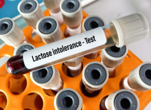 Blood sample for lactose tolerance test, measure the ability of your intestines to break down a type of sugar called lactose.
