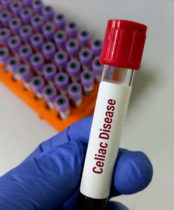 blogg sample for Celiac Disease diagnosis
