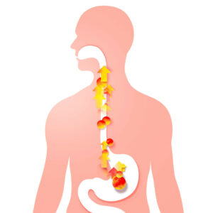 3d illustration of esophagus with gastric reflux and heartburn