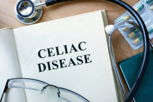 The words “Celiac Disease” are written on a book, with a stethoscope wrapped around it and a glass placed nearby.